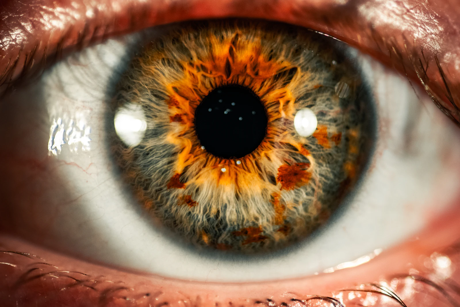 A close-up of a human eye with a grey and orange iris